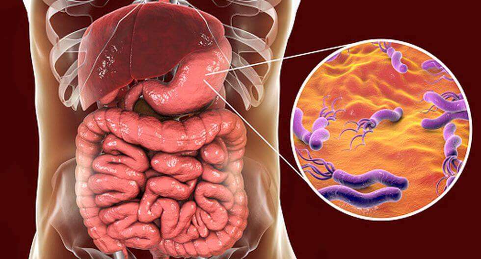 ¿Digestiones lentas y reflujo? Podría ser Helicobacter pylori.