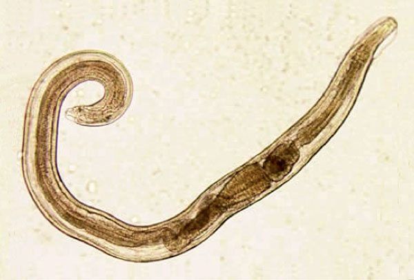 Infecciones parasitarias por nematodos: síntomas, consecuencias y tratamiento.