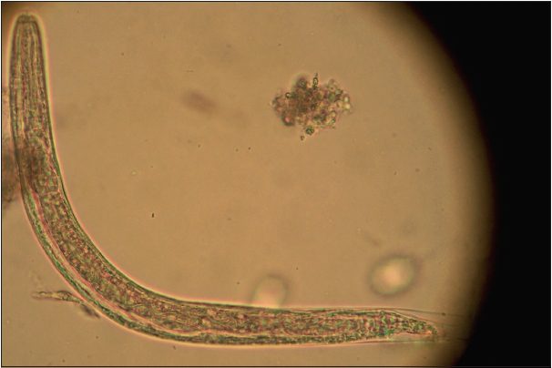Infecciones parasitarias por nematodos: síntomas, consecuencias y tratamiento.