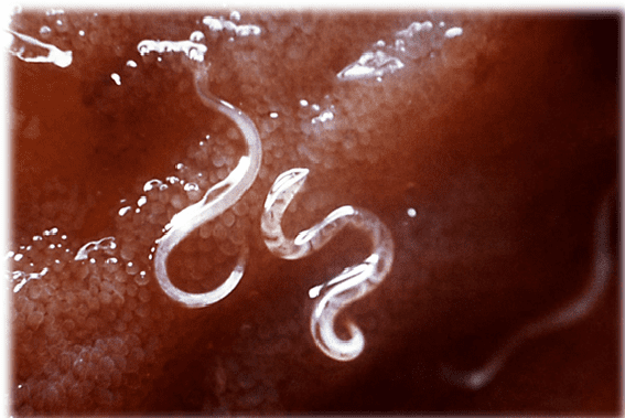 Infecciones parasitarias por nematodos: síntomas, consecuencias y tratamiento.
