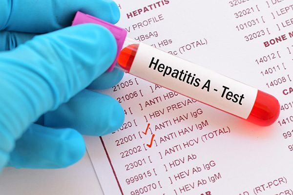 Advierten sobre aumento de casos sospechosos de hepatitis A en Pinar del Río
