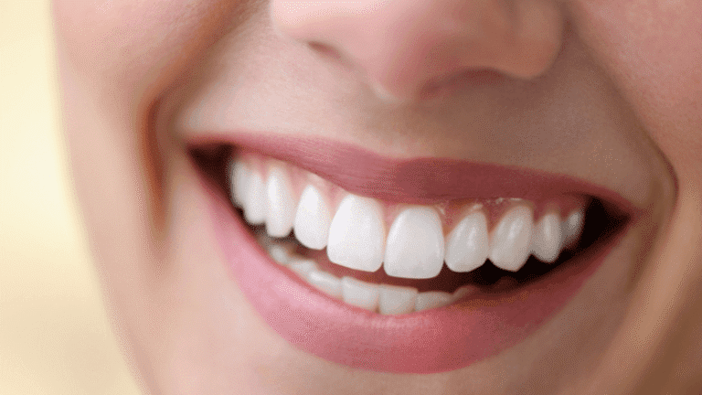 Una curva que lo endereza todo: el poder de una sonrisa.