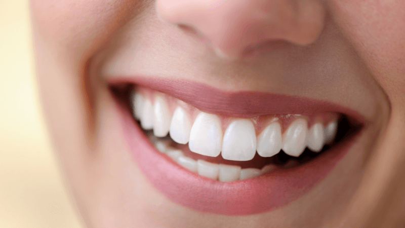 Una curva que lo endereza todo: el poder de una sonrisa.