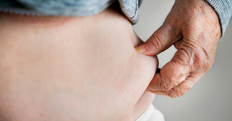 ¿Cómo prevenir y manejar la obesidad en el adulto mayor?