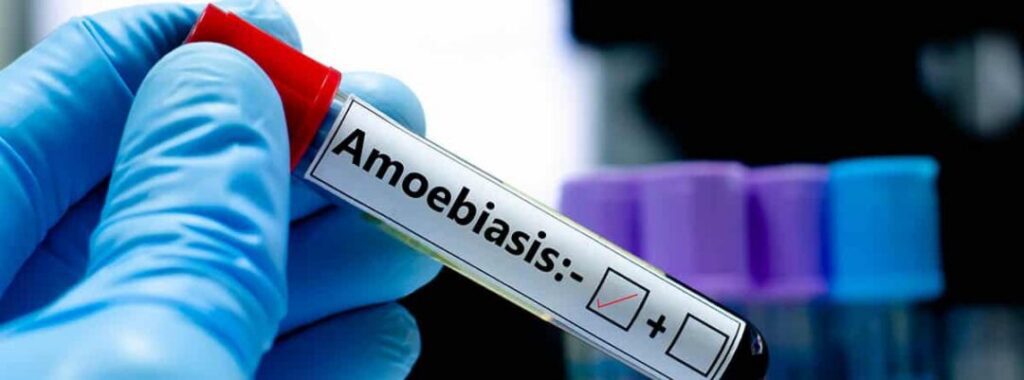 Amebiasis: síntomas, tratamiento y prevención.