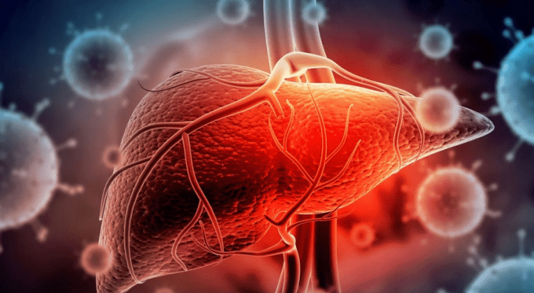Pinar del Río: incremento de hepatitis A en dos municipios